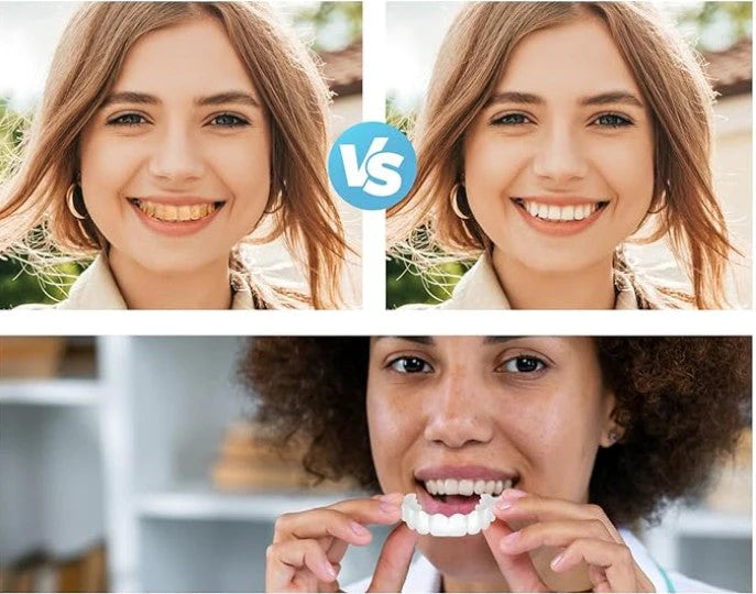 Carillas UltraFit® – Pack Completo - 😁 ¡Transforma tu Sonrisa en Segundos!