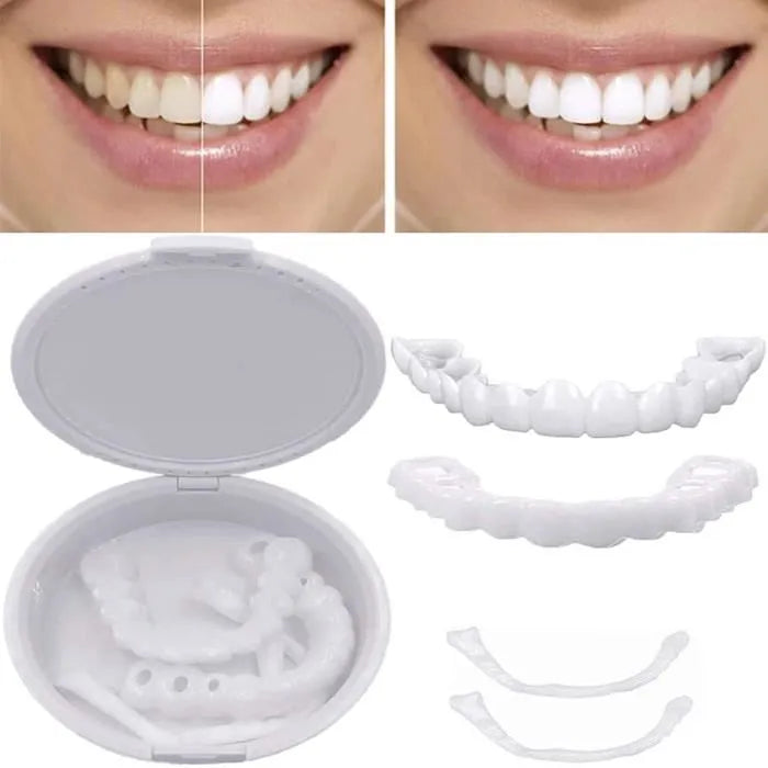 Carillas UltraFit® – Pack Completo - 😁 ¡Transforma tu Sonrisa en Segundos!